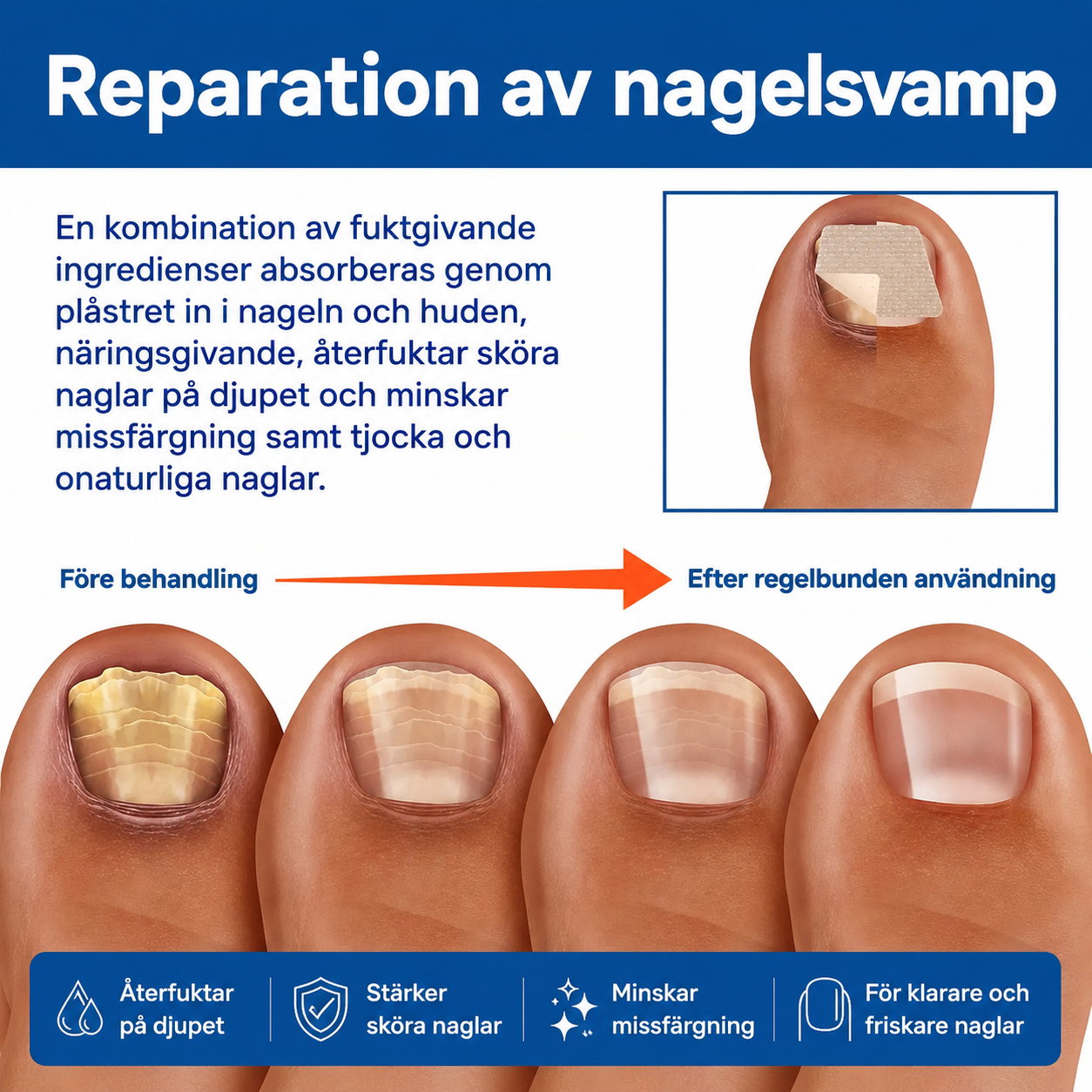 NagelFrisk™ Enkel & diskret behandling mot nagelsvamp